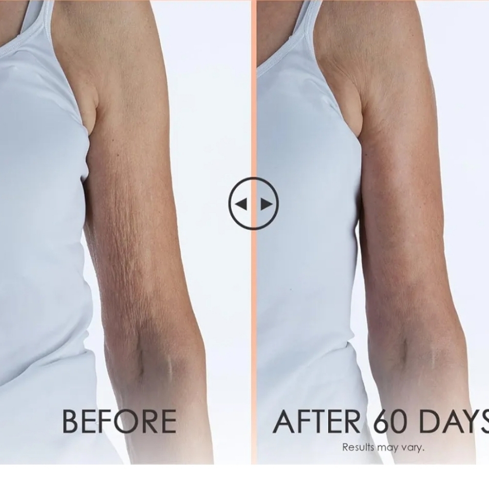 NEW Crêpe Erase Body Serum & Fragrance Free Advanced Body Repair Treatment - Picture 10 of 13